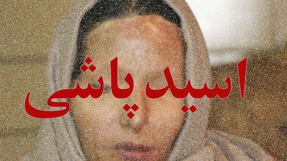 مجازات اسید پاشی